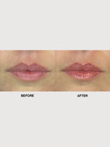 Soft Lips Glow Balm 10 ml | Team Dr. Joseph